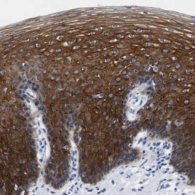 Immunohistochemistry-Paraffin: TRIM29 Antibody [NBP1-88875]