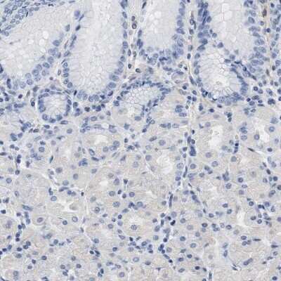 Immunohistochemistry-Paraffin: TRIM29 Antibody [NBP1-88875]