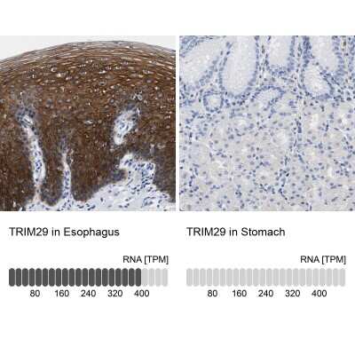 Immunohistochemistry-Paraffin: TRIM29 Antibody [NBP1-88875]