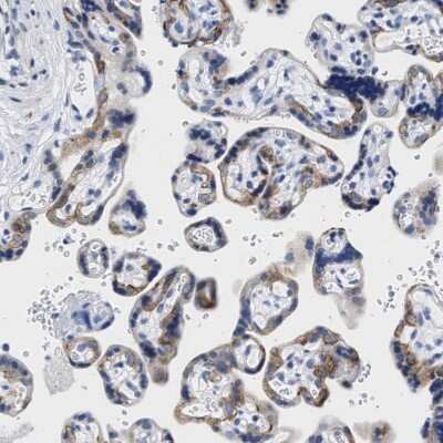 Immunohistochemistry-Paraffin: TRIM29 Antibody [NBP1-88875]