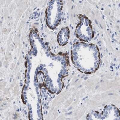Immunohistochemistry-Paraffin: TRIM29 Antibody [NBP1-88875]