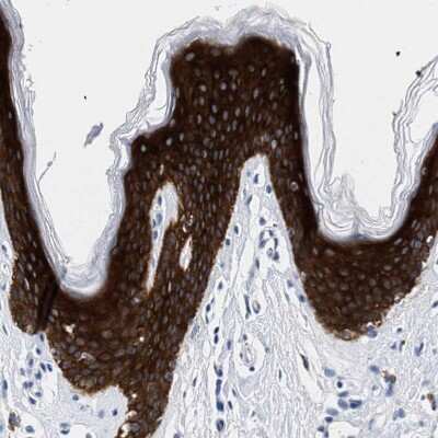 Immunohistochemistry-Paraffin: TRIM29 Antibody [NBP1-88875]