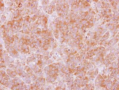 Immunohistochemistry-Paraffin: TRIM29 Antibody [NBP2-20713]
