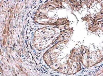 Immunohistochemistry-Paraffin: TRIM29 Antibody [NBP2-20713]
