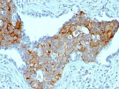 Immunohistochemistry-Paraffin: TRIM29 Antibody (TRIM29/1041) - Azide and BSA Free [NBP2-47808]