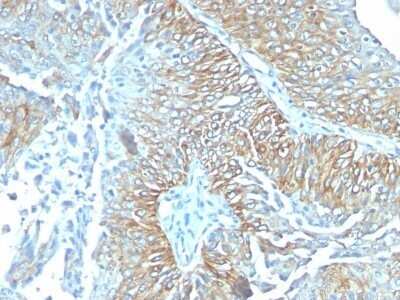 Immunohistochemistry-Paraffin: TRIM29 Antibody (TRIM29/1041) - IHC-Prediluted [NBP2-48093]