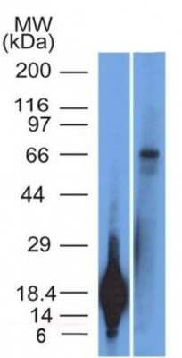 Western Blot: TRIM29 Antibody (TRIM29/1042)Azide and BSA Free [NBP2-47809]