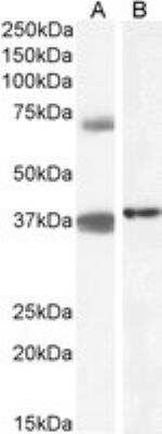 Western Blot: TRIM29 Antibody [NBP1-52000]