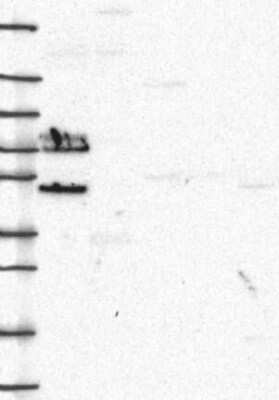 Western Blot: TRIM29 Antibody [NBP3-17646]