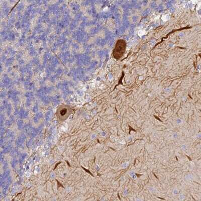Immunohistochemistry: TRIM3/BERP Antibody [NBP2-48791]
