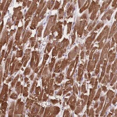 Immunohistochemistry: TRIM3/BERP Antibody [NBP2-48897]