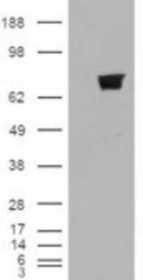 Western Blot: TRIM3/BERP Antibody [NB100-2494]