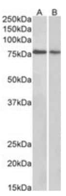 Western Blot: TRIM3/BERP Antibody [NB100-2494]