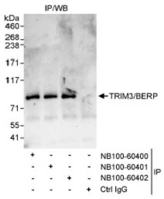 Immunoprecipitation: TRIM3/BERP Antibody [NB100-60400]