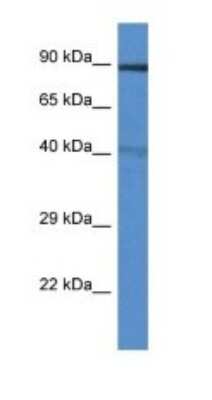 Western Blot: TRIM3/BERP Antibody [NBP1-79699]