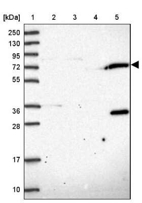 Western Blot: TRIM3/BERP Antibody [NBP2-48791]