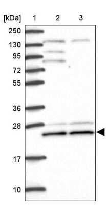 Western Blot: TRIM3/BERP Antibody [NBP2-48897]