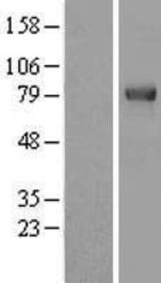 Western Blot: TRIM3/BERP Overexpression Lysate [NBL1-17290]