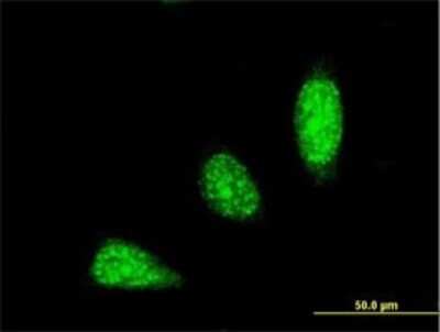 Immunocytochemistry/ Immunofluorescence: TRIM31 Antibody (2G11) [H00011074-M03]