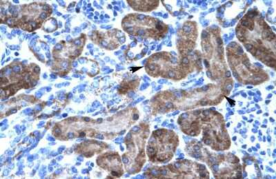 Immunohistochemistry: TRIM31 Antibody [NBP2-88468]