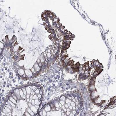 Immunohistochemistry-Paraffin: TRIM31 Antibody [NBP3-17068]