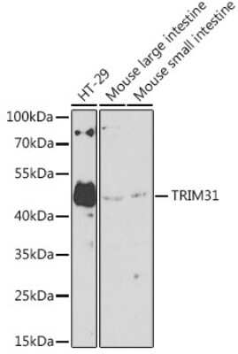 Western Blot: TRIM31 AntibodyBSA Free [NBP2-93541]