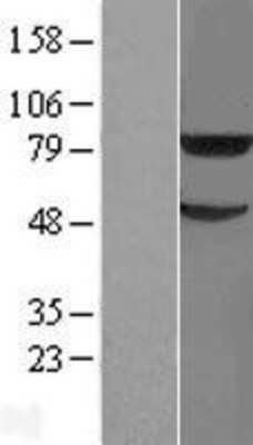 Western Blot: TRIM31 Overexpression Lysate [NBL1-17291]