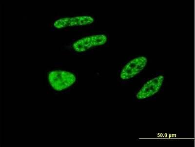 Immunocytochemistry/ Immunofluorescence: TRIM32 Antibody (2E5) [H00022954-M09]