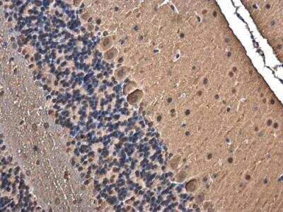 Immunohistochemistry-Paraffin: TRIM32 Antibody [NBP1-33737]