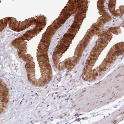 Immunohistochemistry-Paraffin: TRIM32 Antibody [NBP2-13484]