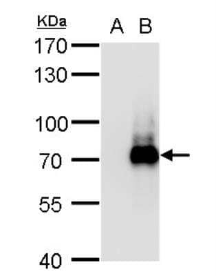 Western Blot: TRIM32 Antibody [NBP1-33737]