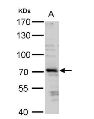 Western Blot: TRIM32 Antibody [NBP1-33737]