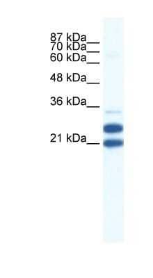 Western Blot: TRIM34 Antibody [NBP1-80050]