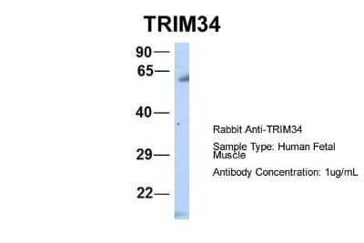 Western Blot: TRIM34 Antibody [NBP1-80359]