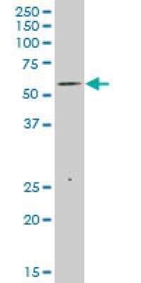 Western Blot: TRIM35 Antibody (4F7) [H00023087-M02]