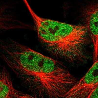 Immunocytochemistry/ Immunofluorescence: TRIM35 Antibody [NBP1-81733]