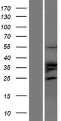 Western Blot: TRIM35 Overexpression Lysate [NBP2-05183]