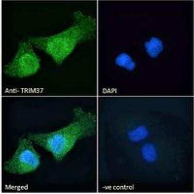 Immunocytochemistry/ Immunofluorescence: TRIM37 Antibody [NBP2-80147]