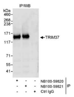 Immunoprecipitation: TRIM37 Antibody [NB100-59820]