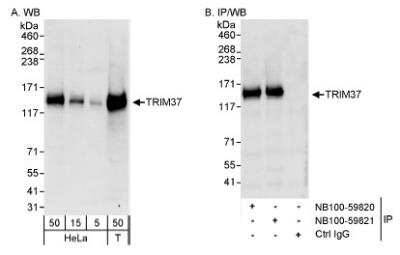 Western Blot: TRIM37 Antibody [NB100-59821]