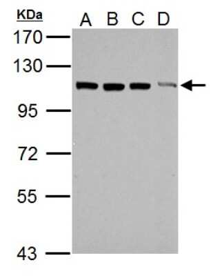 Western Blot: TRIM37 Antibody [NBP2-20715]