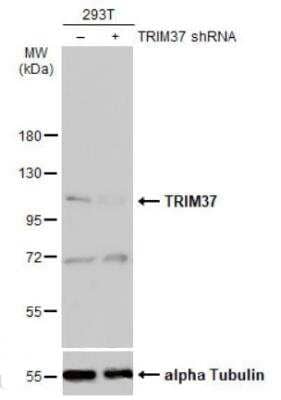 Western Blot: TRIM37 Antibody [NBP2-20715]