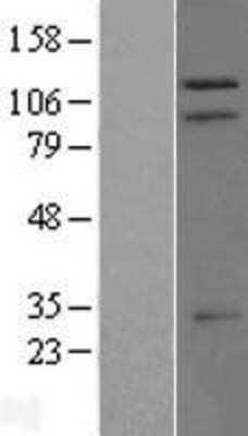 Western Blot: TRIM37 Overexpression Lysate [NBP2-09094]