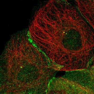 Immunocytochemistry/ Immunofluorescence: TRIM38 Antibody [NBP1-87126]