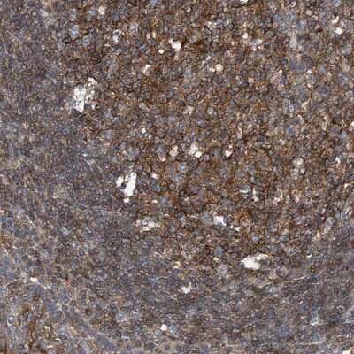 Immunohistochemistry-Paraffin: TRIM38 Antibody [NBP1-87126]