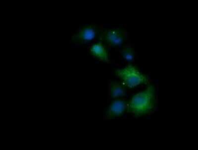 Immunocytochemistry/ Immunofluorescence: TRIM38 Antibody (OTI113D3) - Azide and BSA Free [NBP2-74610]