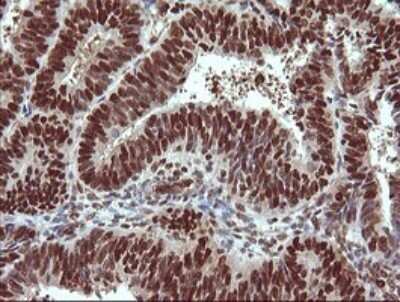 Immunohistochemistry: TRIM38 Antibody (OTI113D3) - Azide and BSA Free [NBP2-74610]