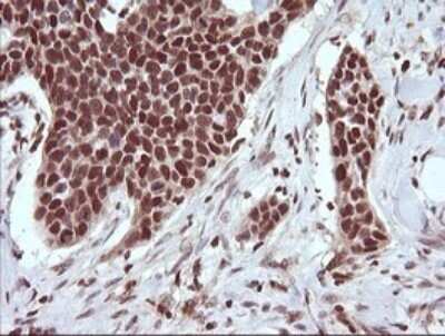 Immunohistochemistry: TRIM38 Antibody (OTI113D3) - Azide and BSA Free [NBP2-74610]
