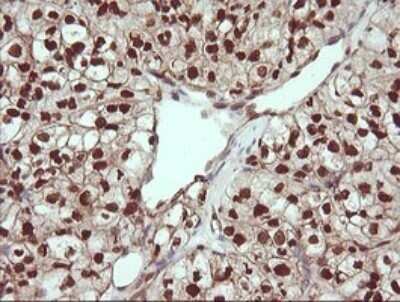 Immunohistochemistry: TRIM38 Antibody (OTI113D3) - Azide and BSA Free [NBP2-74610]