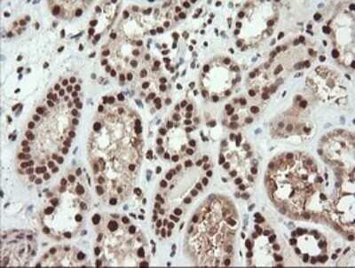 Immunohistochemistry: TRIM38 Antibody (OTI113D3) - Azide and BSA Free [NBP2-74610]